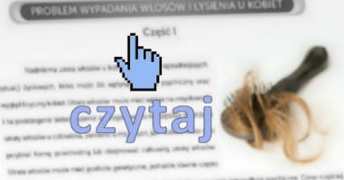 Problem wypadania włosów i łysienia u kobiet